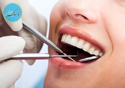 ۶ راه طبیعی سفید کردن دندان‌ها