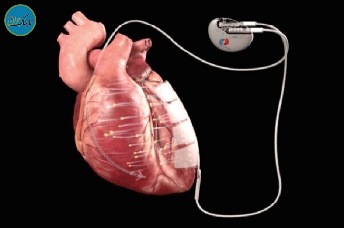 درمان بیماری‌های قلبی با برق 