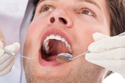 چه زمانی دندان عقل را بکشیم؟