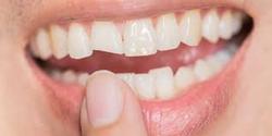 7 عادتی که دندان‌های ما را خراب می‌کند