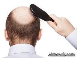 چرا دچار ریزش مو می‌شویم؟
