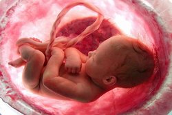 مهم ترین علت بروز سقط مکرر زودرس