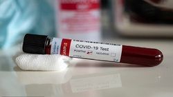 تشخیص مرگبار بودن ویروس کرونا با آزمایش خون