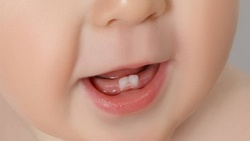 علت کاهش وزن کودکان در زمان دندان درآوردن