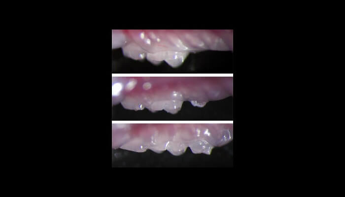 کشفی جالب درباره احتمال رشد دندان های جدید در بزرگسالی