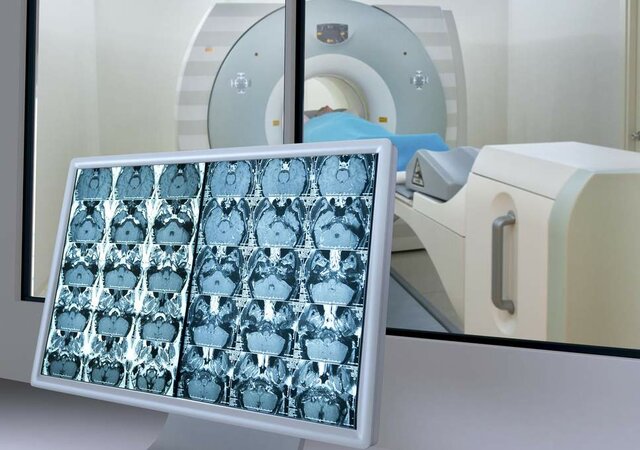 مغز زنان جوان‌تر از مغز مردان است!