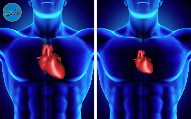 عجیب‌ترین اتفاقاتی که در فضا برایتان رخ می دهد+ تصاویر