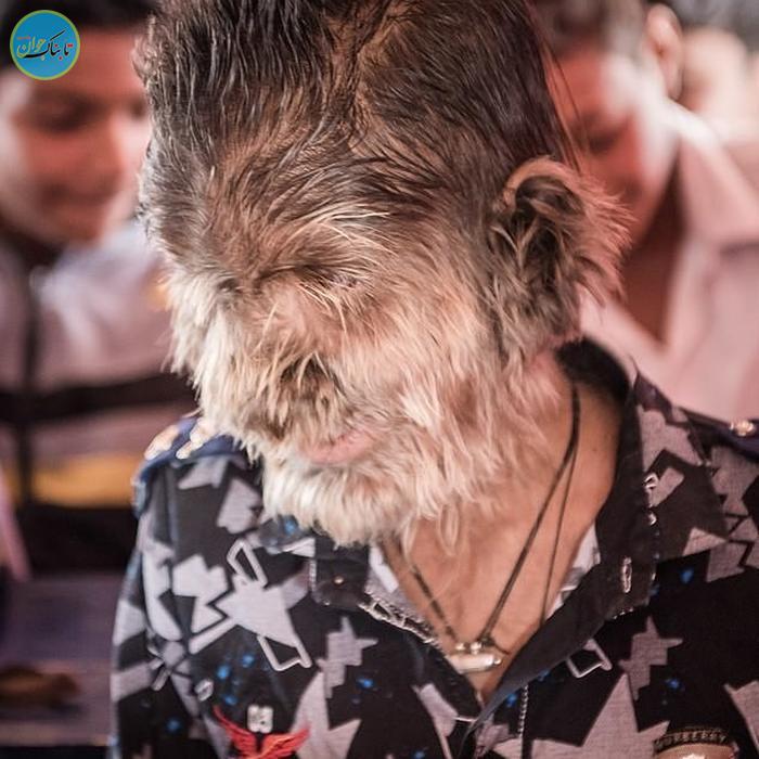 ماجرای حیرت‌آور پسربچه گرگ‌نما در هند +تصاویر