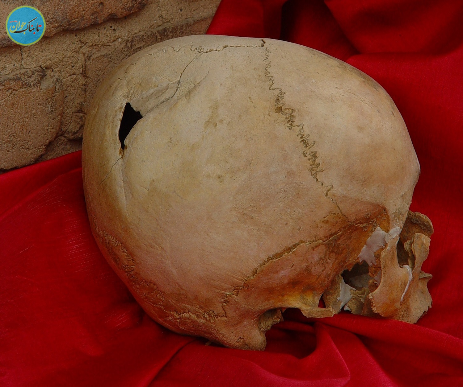 بازار داغ پزشکان زیبایی در دنیای باستان!