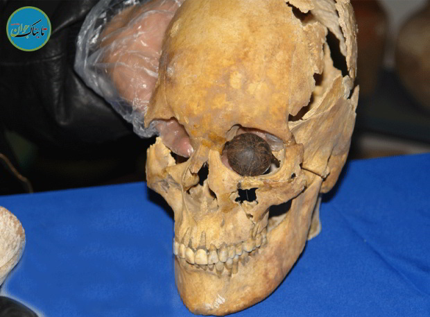 بازار داغ پزشکان زیبایی در دنیای باستان!