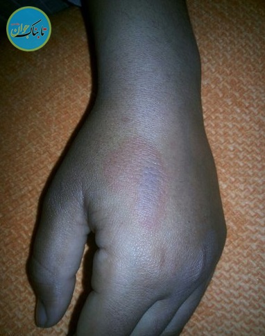 جزییات اقدام وحشیانه معلم نظرآبادی +عکس جزییات اقدام وحشیانه معلم نظرآبادی +عکس