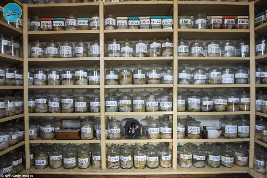 نگاهی به موزه مغز های واقعی انسان!/ تصاویر