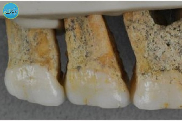 کشف فسیل گونه‌ ناشناخته‌ای از انسان+تصاویر