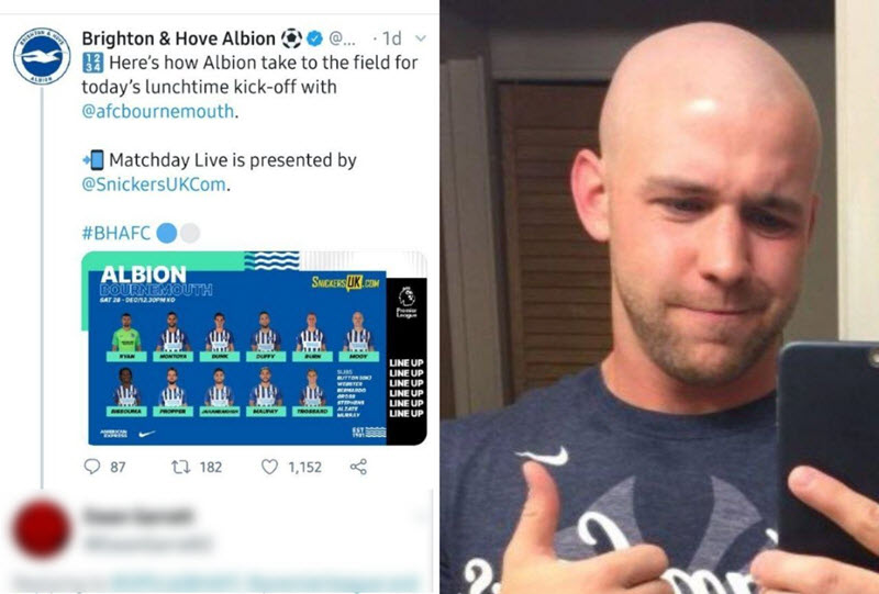 طرفدار تیم برایتون کچل کرد