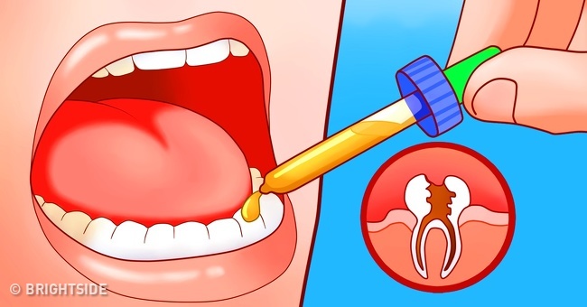 ۸ درمان خانگی برای دندان درد