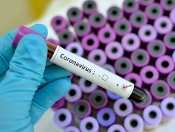 تمهیدات ایران برای جلوگیری از شیوع ویروس کرونا