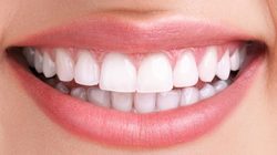 ۶ نکته برای داشتن دندان‌های سالم