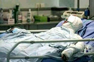 مصدومیت ۳ نوجوان بر اثر انفجار مواد محترقه