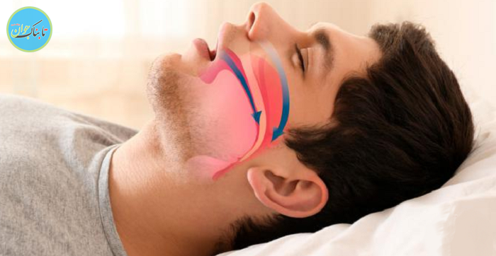 منشا خروپف کجاست؟