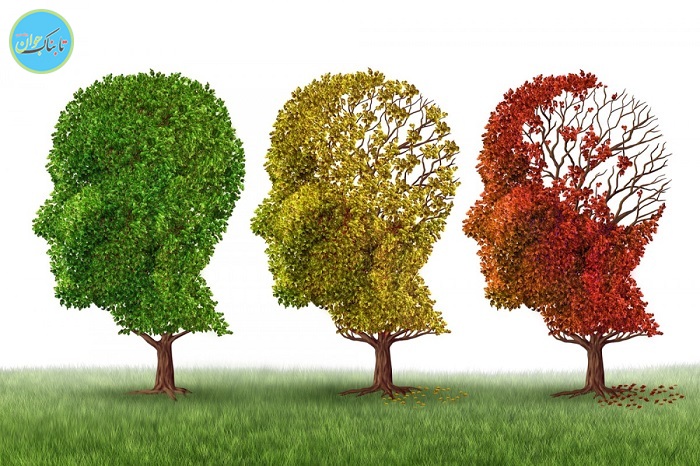 تشخیص آلزایمر 30 سال قبل از بروز علائم اولیه