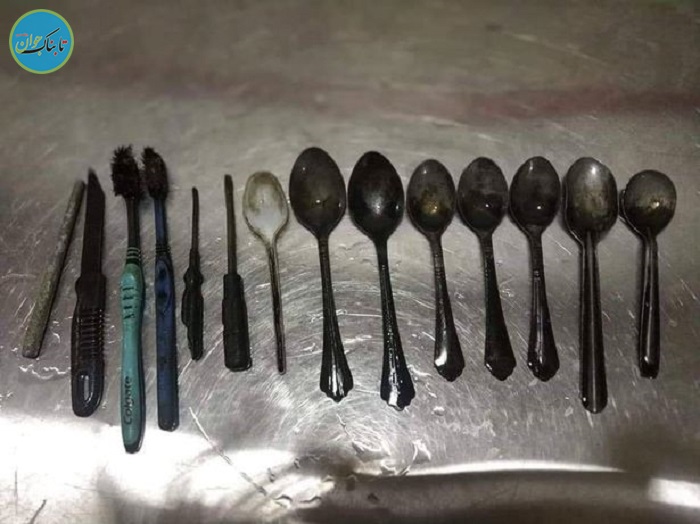 پیدا شدن اشیاء باورنکردنی در معده مرد هندوستانی! +عکس