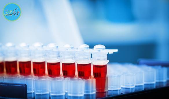 شیوه خواندن آزمایش خون
