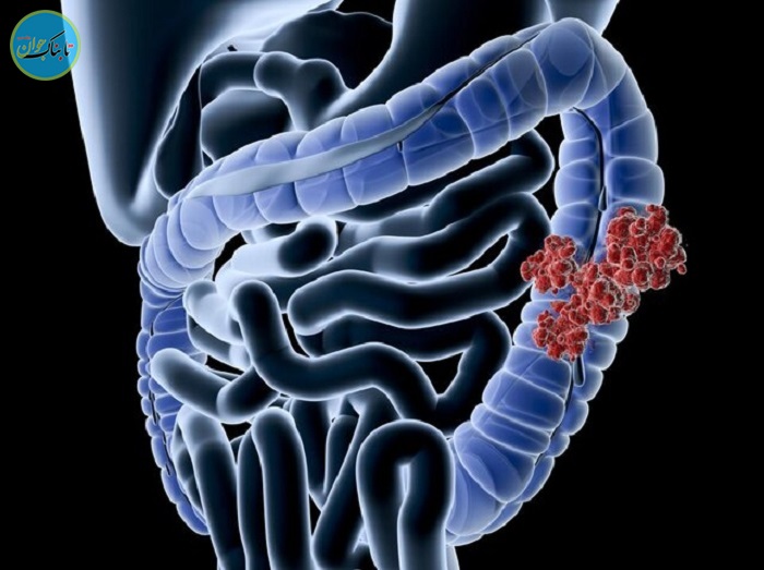 بسته خبری : اظهارات جنجالی آقای بازیگر در حمایت از نابرابری های اجتماعی