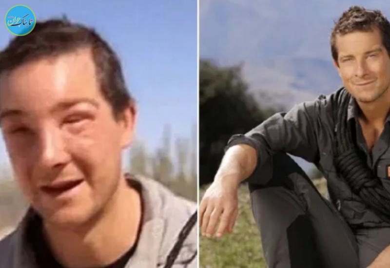 زنبور گزیدگی مجری تلویزیونی