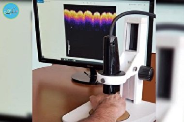 تاثیر جاذبه اندک برای از بین بردن سرطان