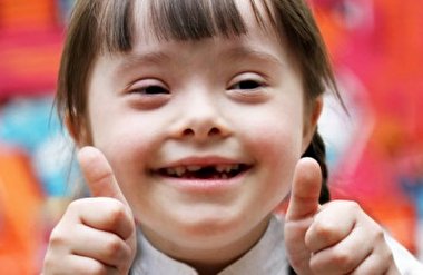 هنر خیره کننده افراد مبتلا به سندروم دان+فیلم