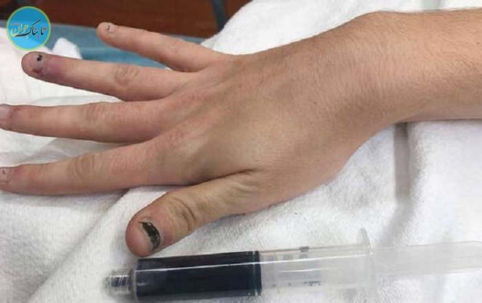 خون آبی یک زن آمریکایی