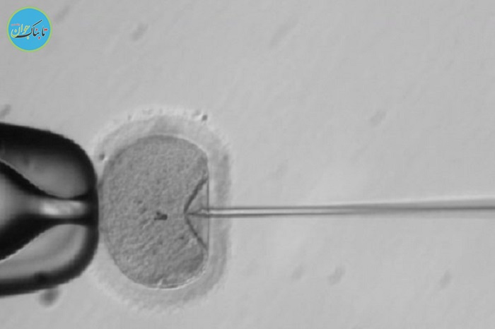  ژن عامل ناباروری 