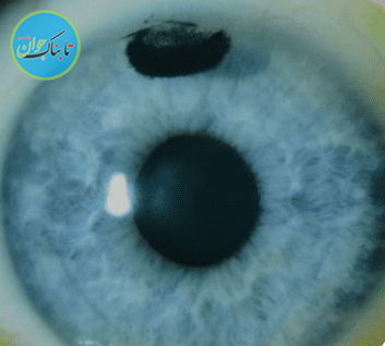 عجیب‌ترین عمل‌های جراحی جهان