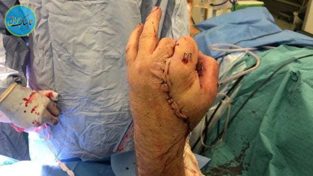 عجیب‌ترین عمل‌های جراحی جهان