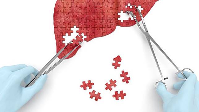 ۵ میوه برای درمان کبد چرب