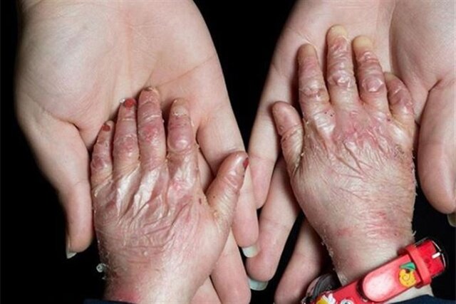 حقوق بشر آمریکایی به 