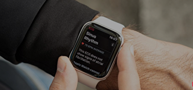 اپل به دنبال تشخیص حرکات ماهیچه با ساعت‌های هوشمند