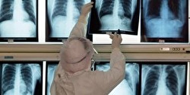 سریع‌ترین روش تشخیص کرونا چیست؟