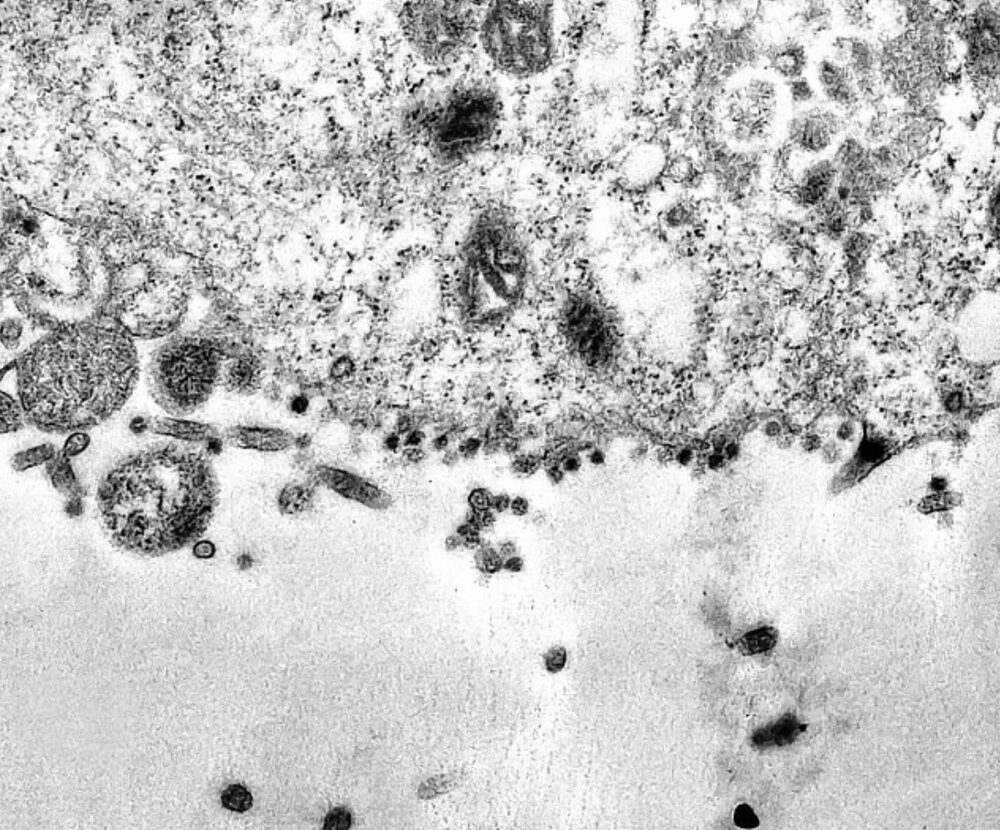 لحظه ورود کووید ۱۹ به سلول ثبت شد