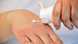 چگونه پوست دست را از خشک شدن نجات دهیم؟