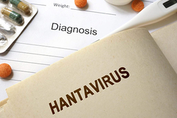 علایم و درمان هانتا ویروس را بشناسید