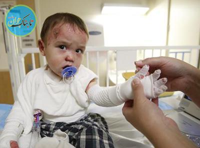 بیماری نادر