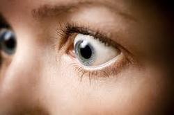 از بیماری تیروئید چشم چه می دانید؟