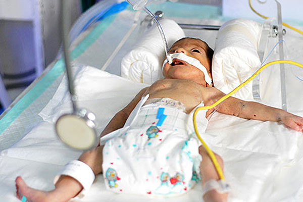 غربالگری چیست