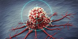 گرسنگی سلول‌های سرطانی؛ روش جدید درمان سرطان