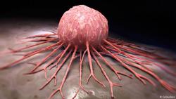 کشف راهبرد درمانی جدیدی برای مهار سرطان روده بزرگ