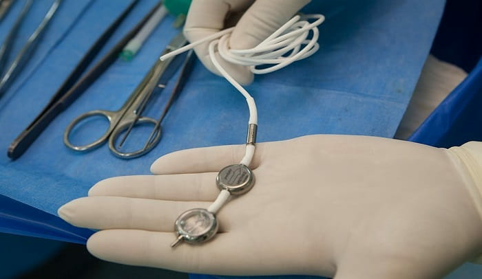 شانت مغزی چیست؟