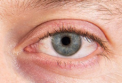 جلوگیری از خشکی چشم با تکنیک ۲۰۲۰