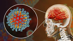 حمله ویروس کرونا به «مغز» ثابت شد