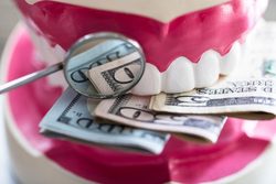 آیا دندانپزشک‌ها پول پارو می‌کنند؟
